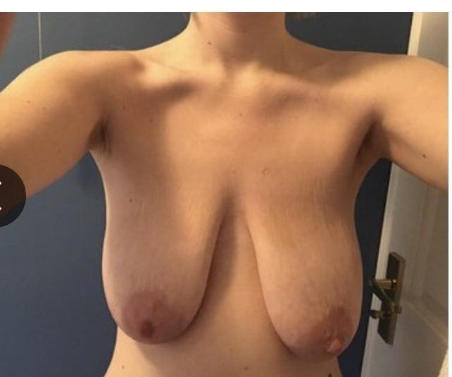25P Saggy 13