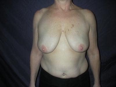 25P Saggy breast vol 27