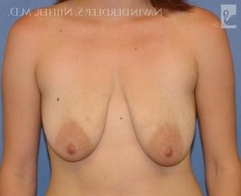 25P Saggy breast vol 27