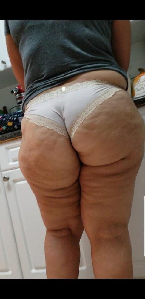 25P Thick, White and Cellulite 144