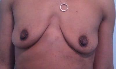 25P Saggy breast vol 28
