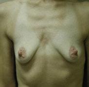 25P Saggy breast vol 28