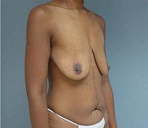 25P Saggy breast vol 28