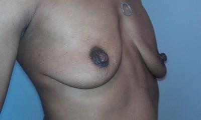 25P Saggy breast vol 28