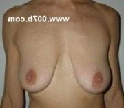 25P Saggy breast vol 28
