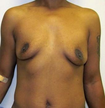 25P Saggy breast vol 28