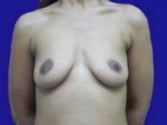 25P Saggy breast vol 28