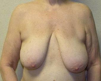 18P Saggy breast vol 29