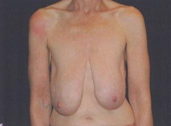 18P Saggy breast vol 29