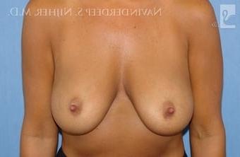18P Saggy breast vol 29