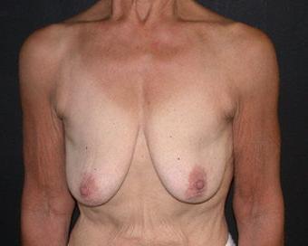 18P Saggy breast vol 29