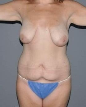 18P Saggy breast vol 29