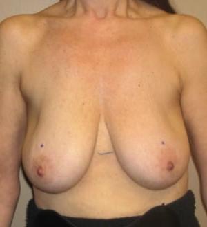 18P Saggy breast vol 29
