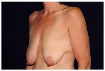 18P Saggy breast vol 29