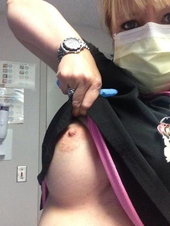 25P Nurse Tits