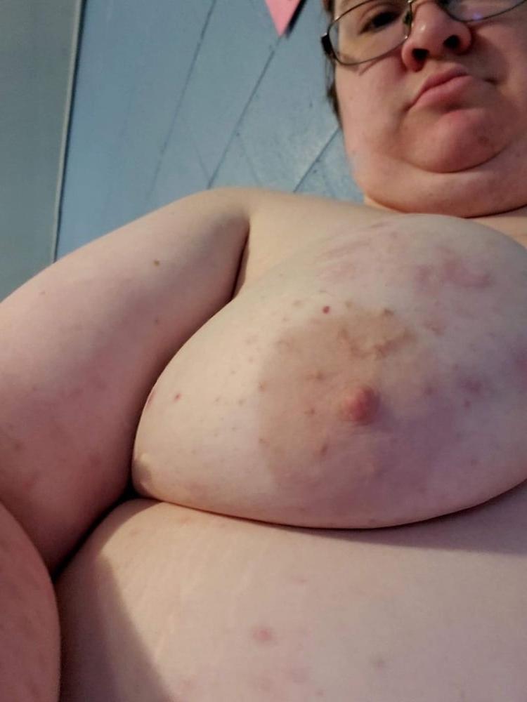 25P Hoodyman SSBBW 336 . Nude piggy special.