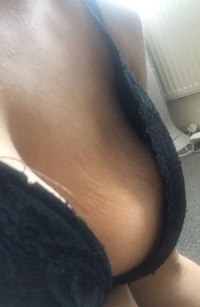 25P Saggy breast vol 25