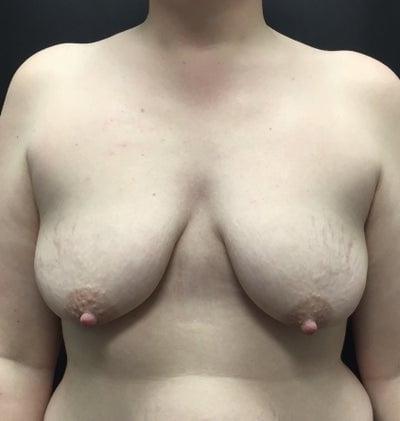 24P Saggy breast vol 26