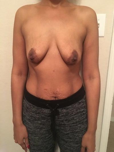 24P Saggy breast vol 26