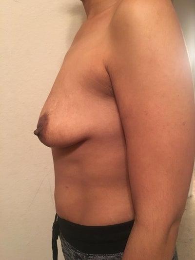 24P Saggy breast vol 26