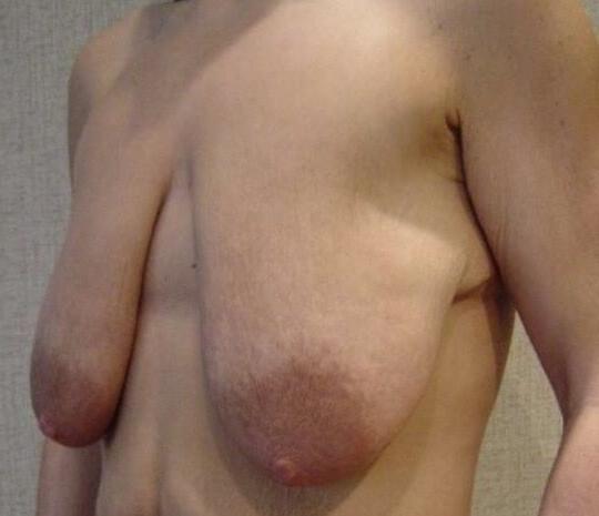 20P saggy