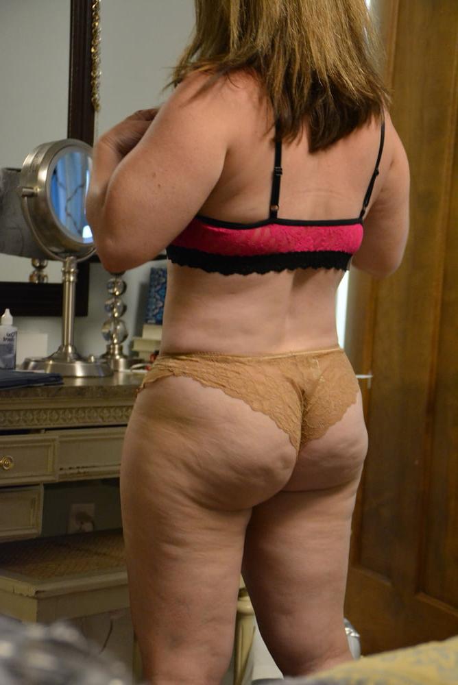 25P Thick, White and Cellulite 143