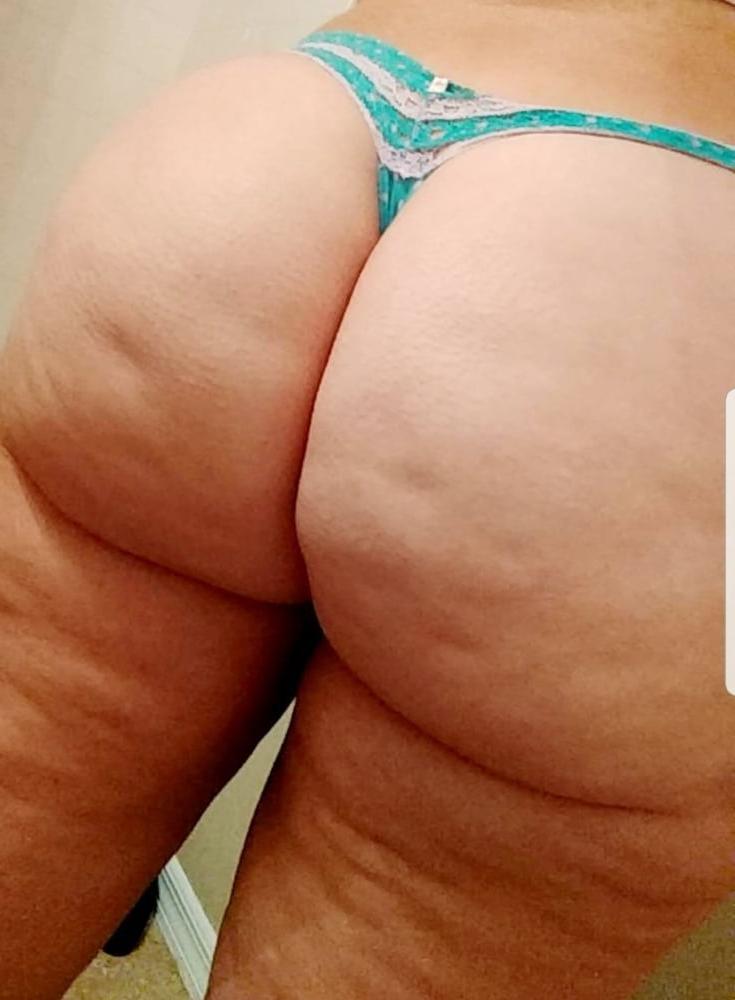 25P Thick, White and Cellulite 143