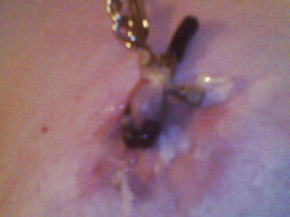 9P Fun with hot-wax....