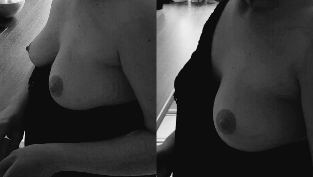 9P black and white