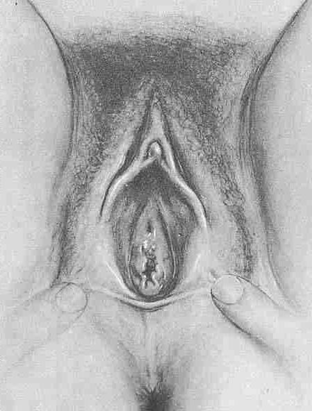 25P gyno mix1