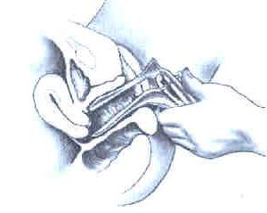 25P gyno mix1