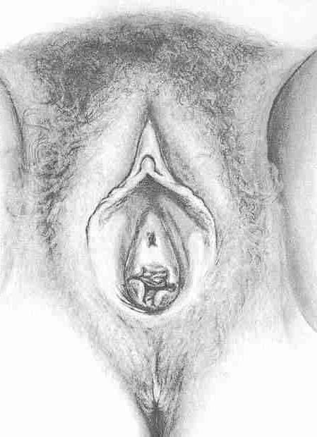 25P gyno mix1