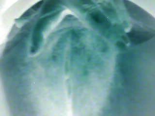 6P Weird hairy pics