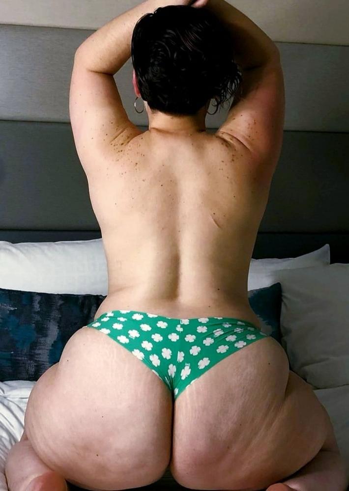 25P Thick, White and Cellulite 141