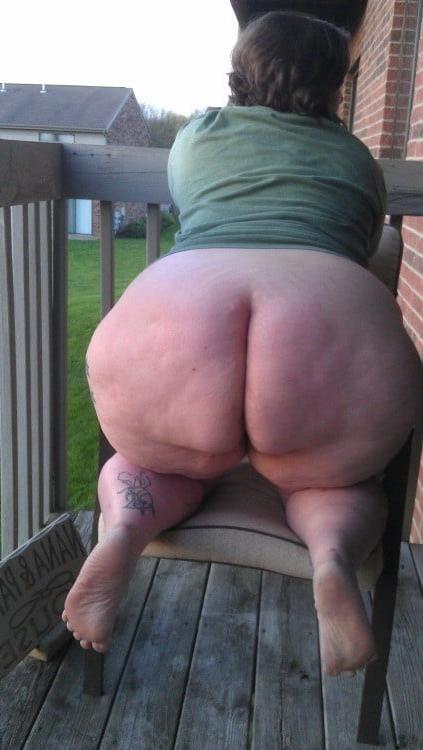 25P Thick, White and Cellulite 140