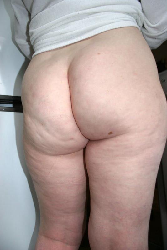 25P Thick, White and Cellulite 138
