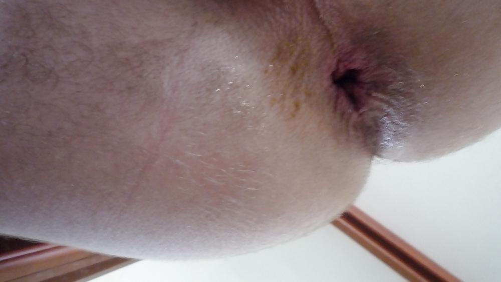 17P Deep penetration