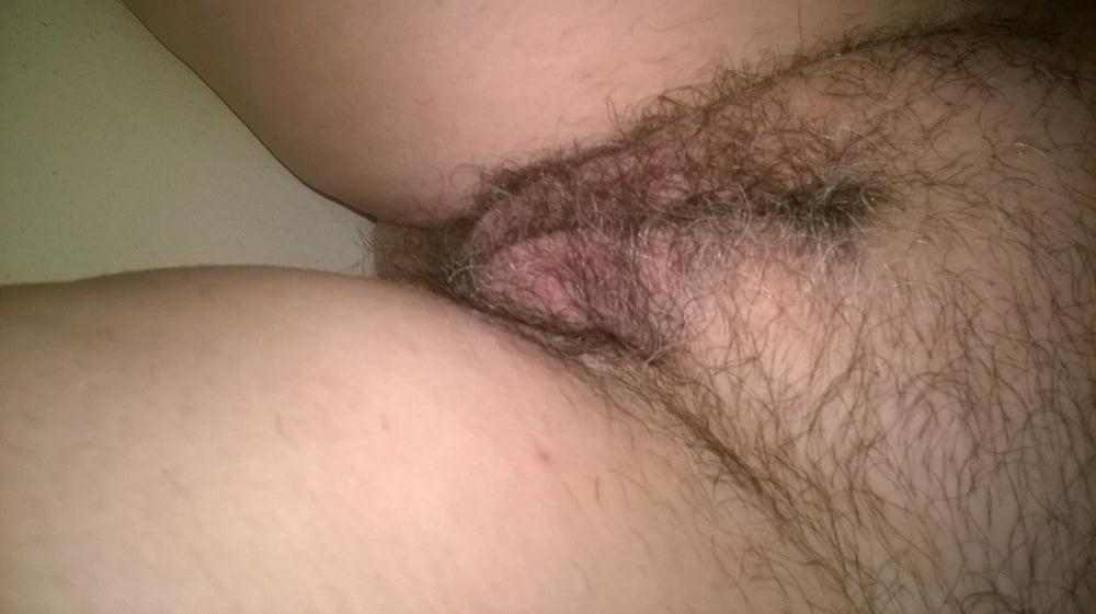 5P Hairy