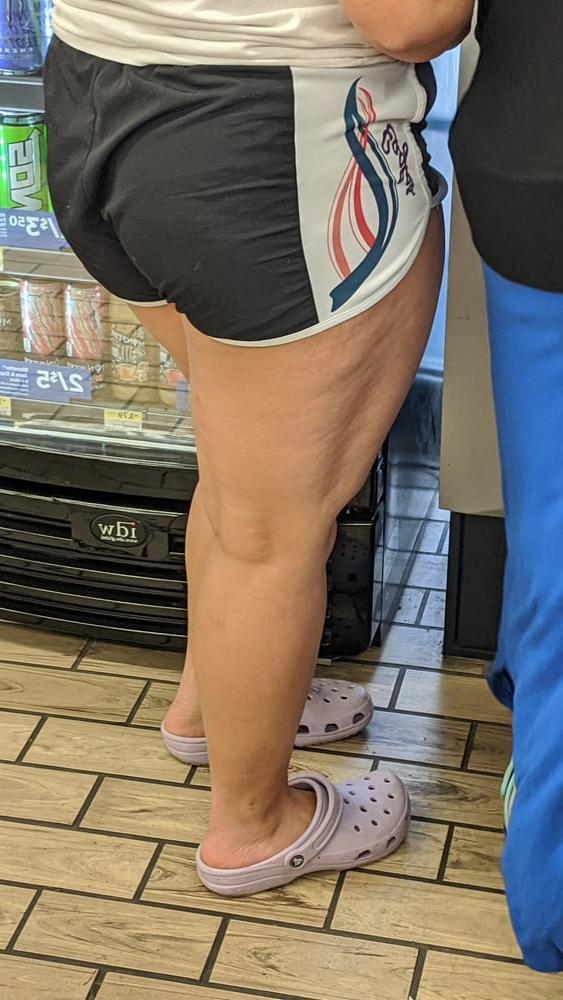 24P This 22 old slut has big legs