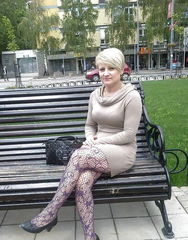 25P Hot legs