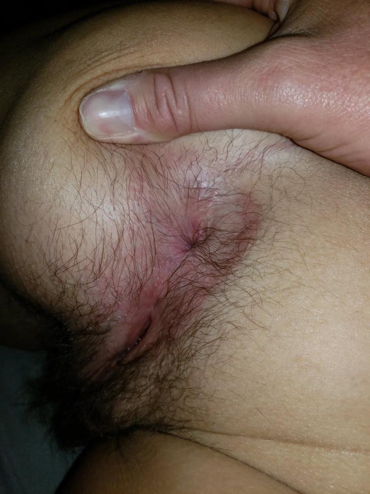 11P Hairy pussy