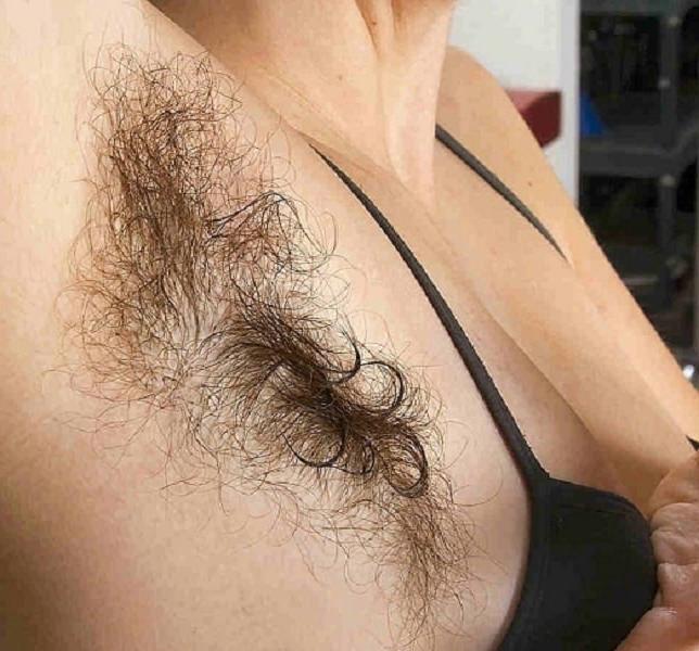 25P HAIRY