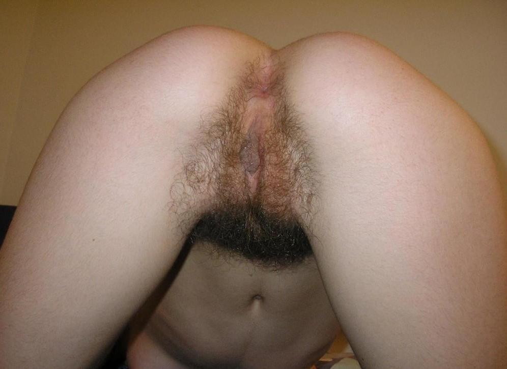 25P HAIRY