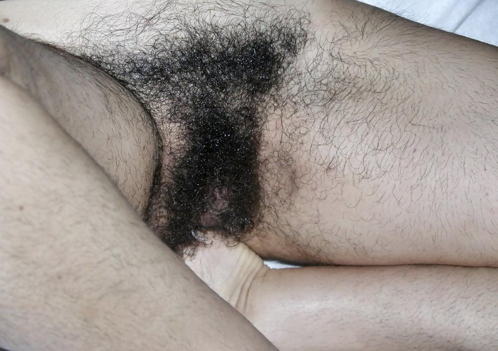 25P HAIRY