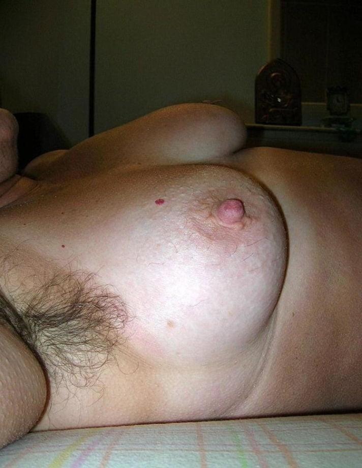 25P HAIRY