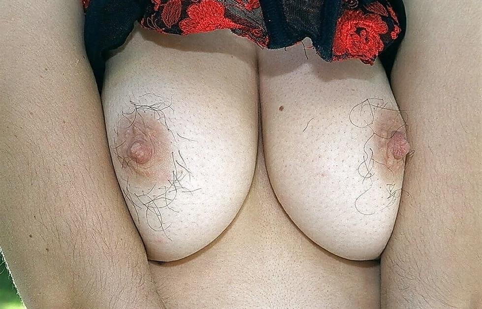 25P HAIRY