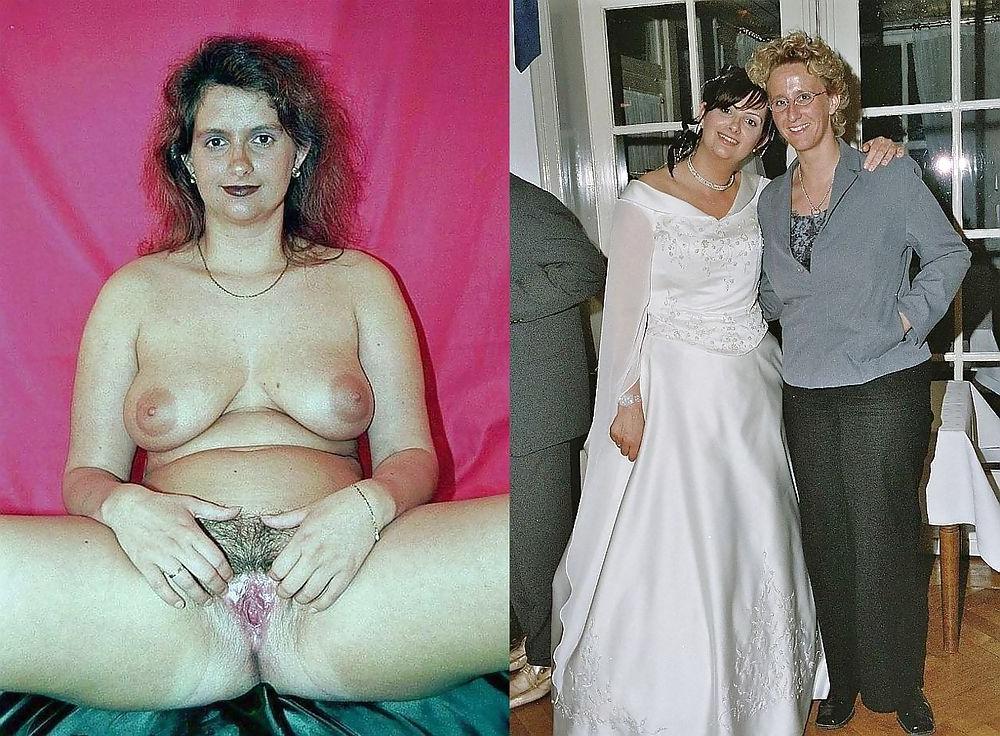 25P Mature milf dressed undressed 2