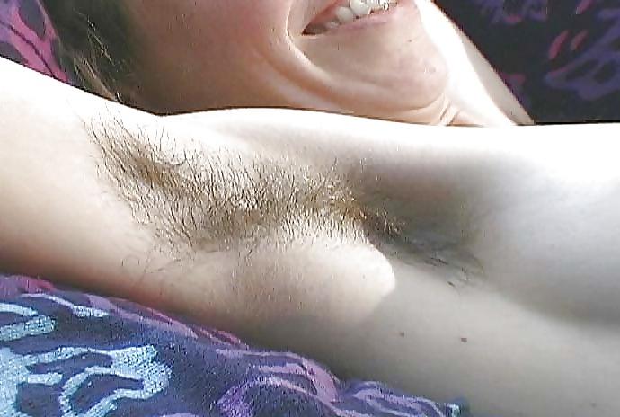 25P Hairy Underarms 2
