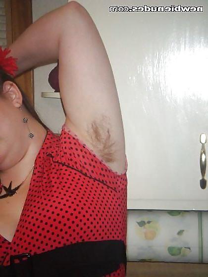 25P Hairy Underarms 2
