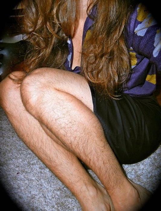 10P Hairy legs 1